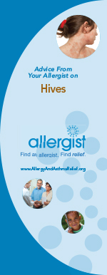 Hives: Advice from Your Allergist